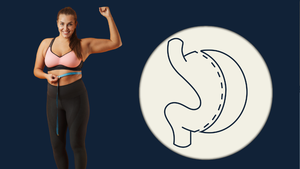 Manga Gástrica en Bogotá