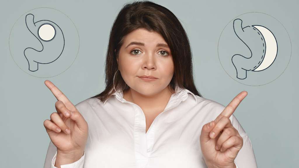 Balón o Manga Gástrica Dr Felipe Bernal Cirujano Bariático