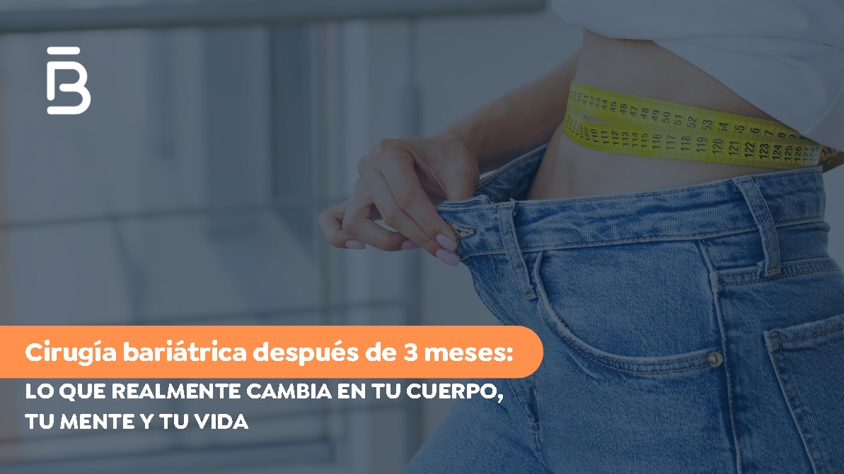 cirugía bariátrica después de 3 meses- Dr. Felipe Bernal- Cirujano Bariátrico