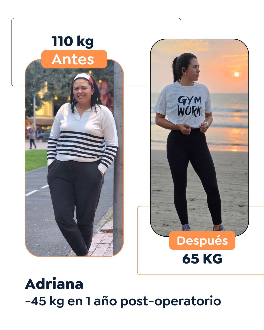 Antes y después Cirugía Bariátrica en Bogotá Dr. Felipe Bernal - Manga gástrica antes y después - Bypass Gástrico Antes y después