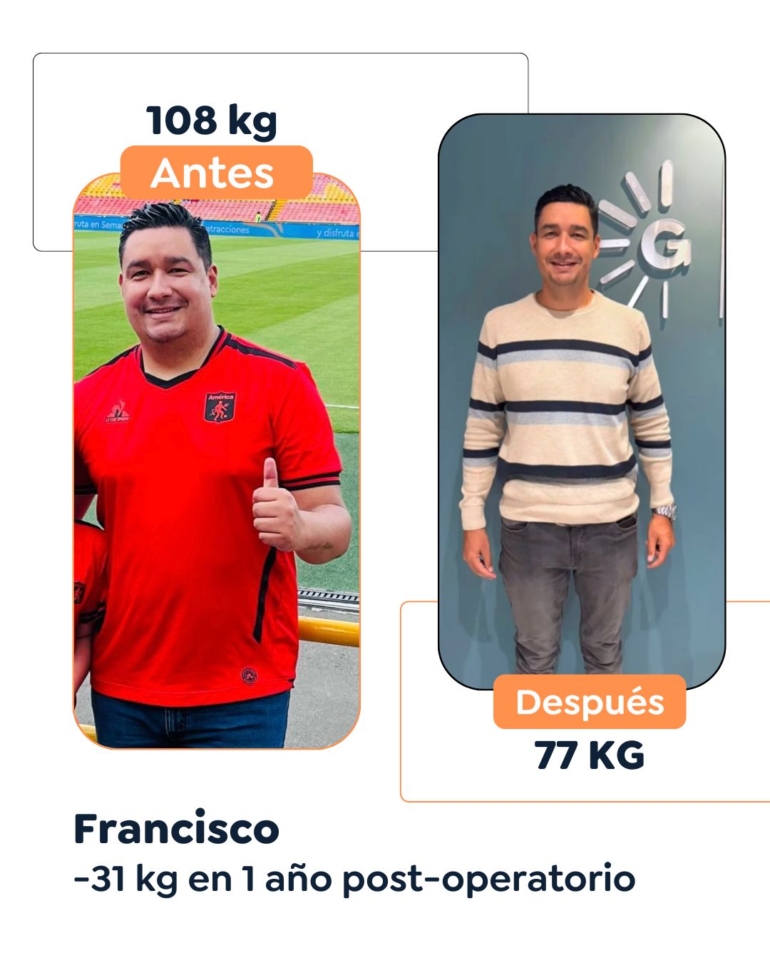Antes y después Cirugía Bariátrica en Bogotá Dr. Felipe Bernal - Manga gástrica antes y después - Bypass Gástrico Antes y después
