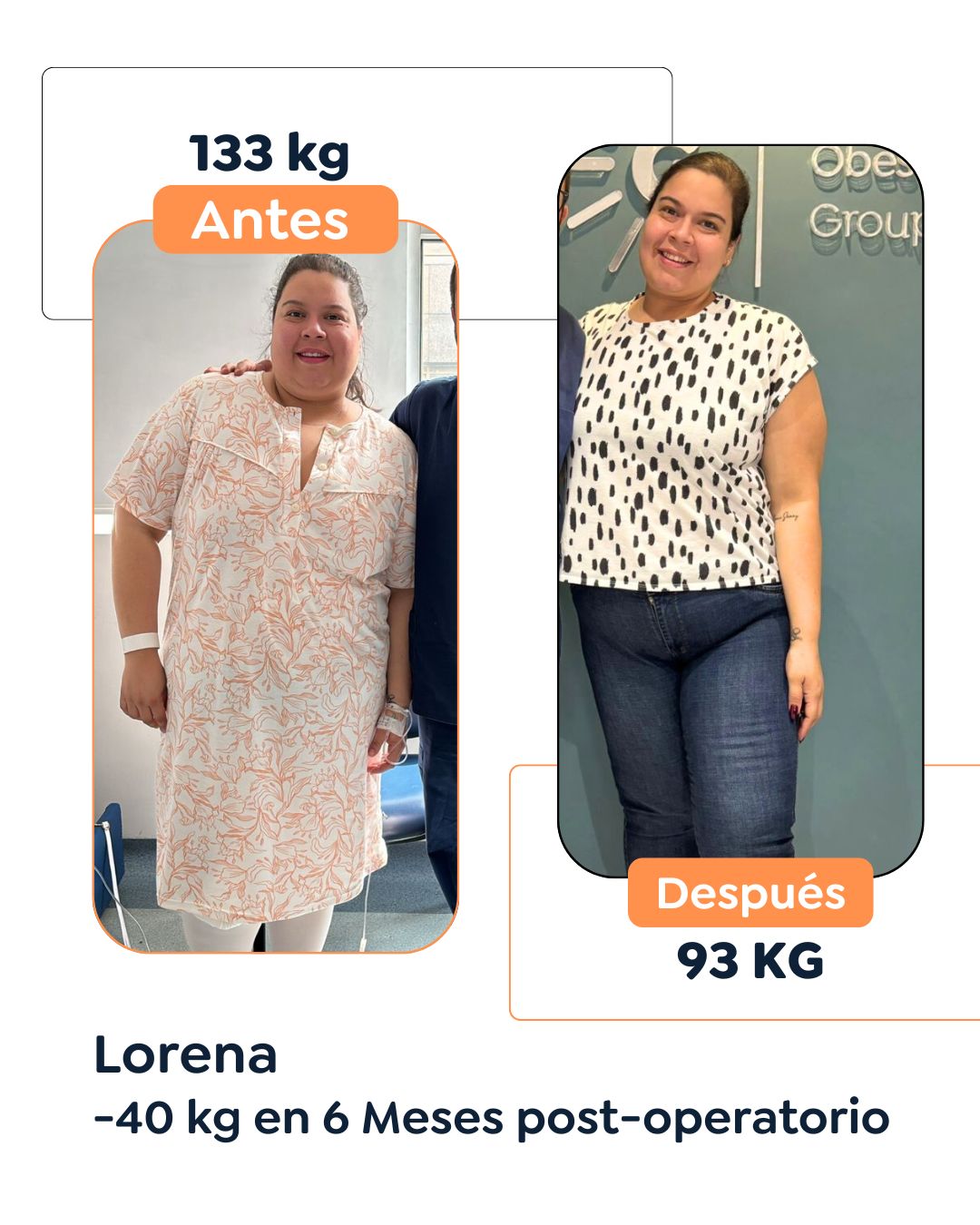Antes y después Cirugía Bariátrica en Bogotá Dr. Felipe Bernal - Manga gástrica antes y después - Bypass Gástrico Antes y después