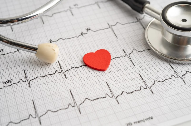 Antecedentes de enfermedad cardiaca para candidatos a cirugía bariátrica - Dr. Felipe Bernal