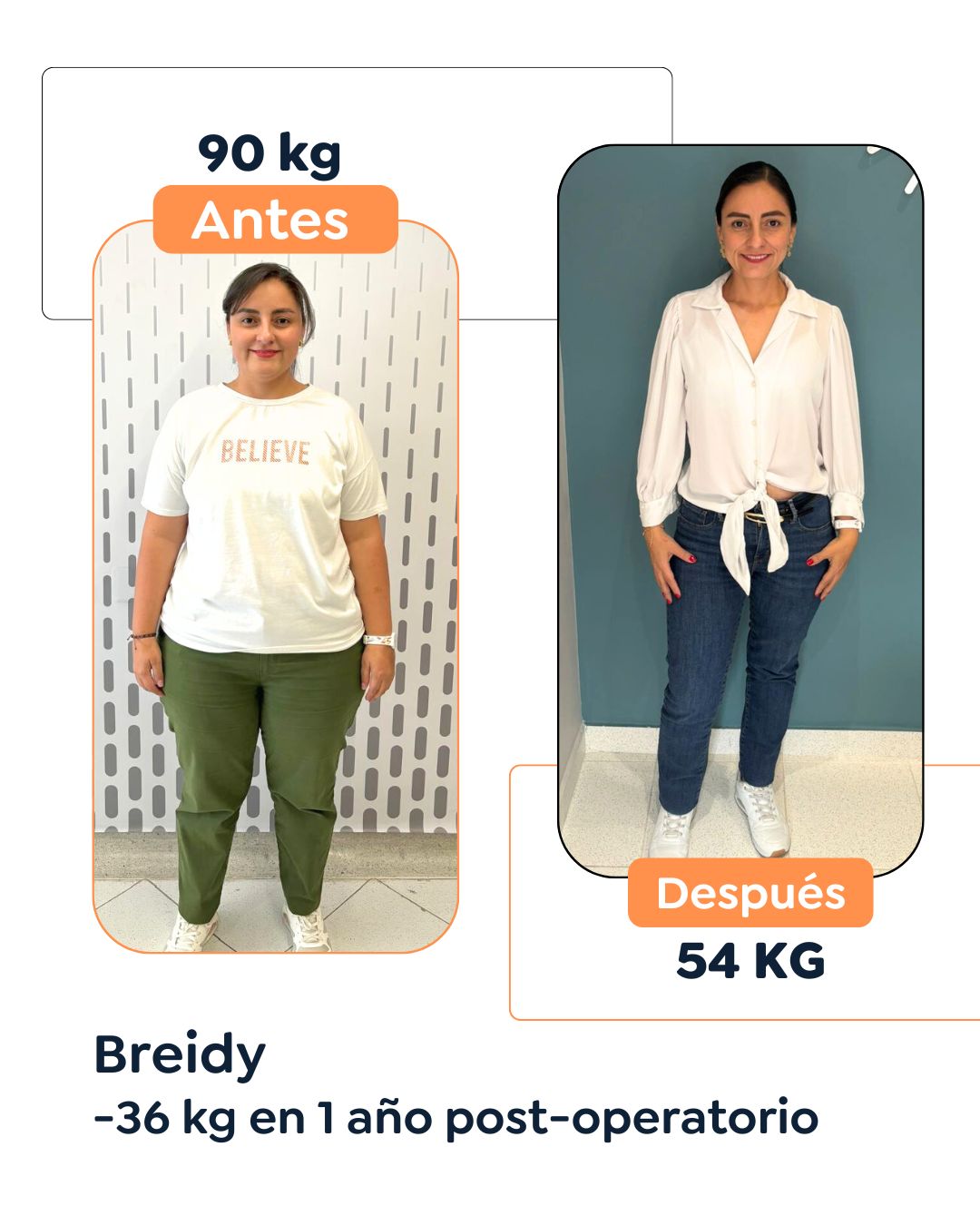 Antes y después de cirugía bariátrica en Bogotá con el Dr. Felipe Bernal - 011025 2