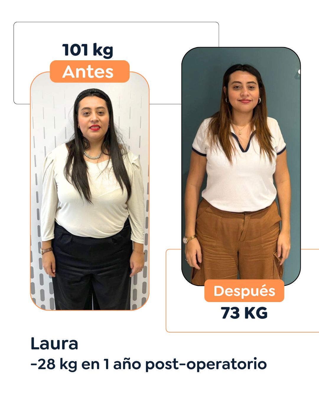 Antes y después de cirugía bariátrica en Bogotá con el Dr. Felipe Bernal - 011025 3