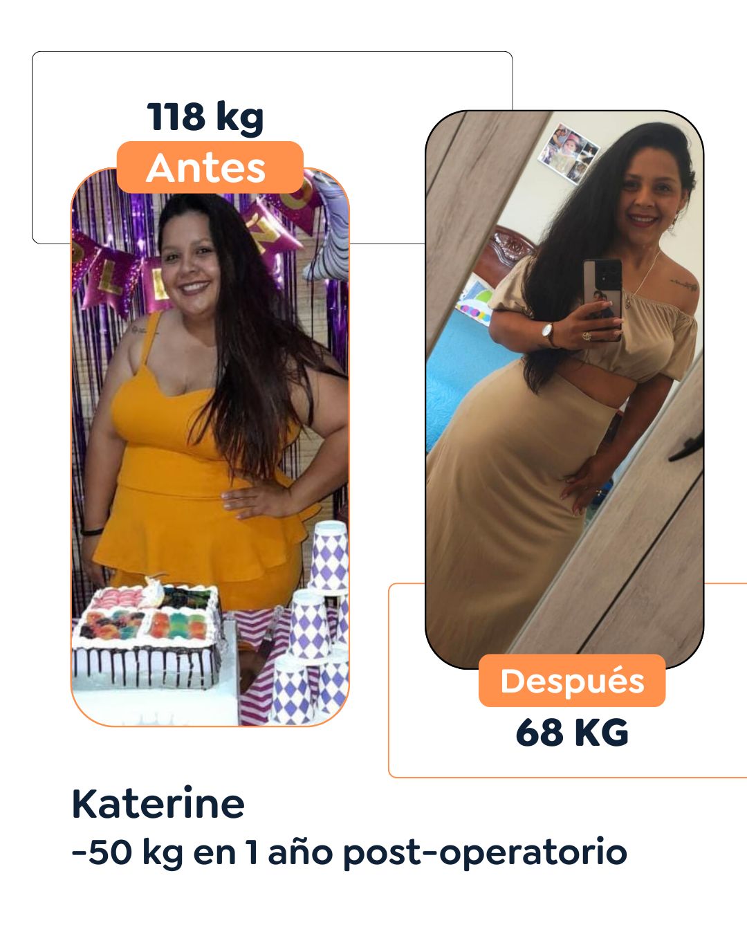 Antes y después de cirugía bariátrica en Bogotá con el Dr. Felipe Bernal - 011025