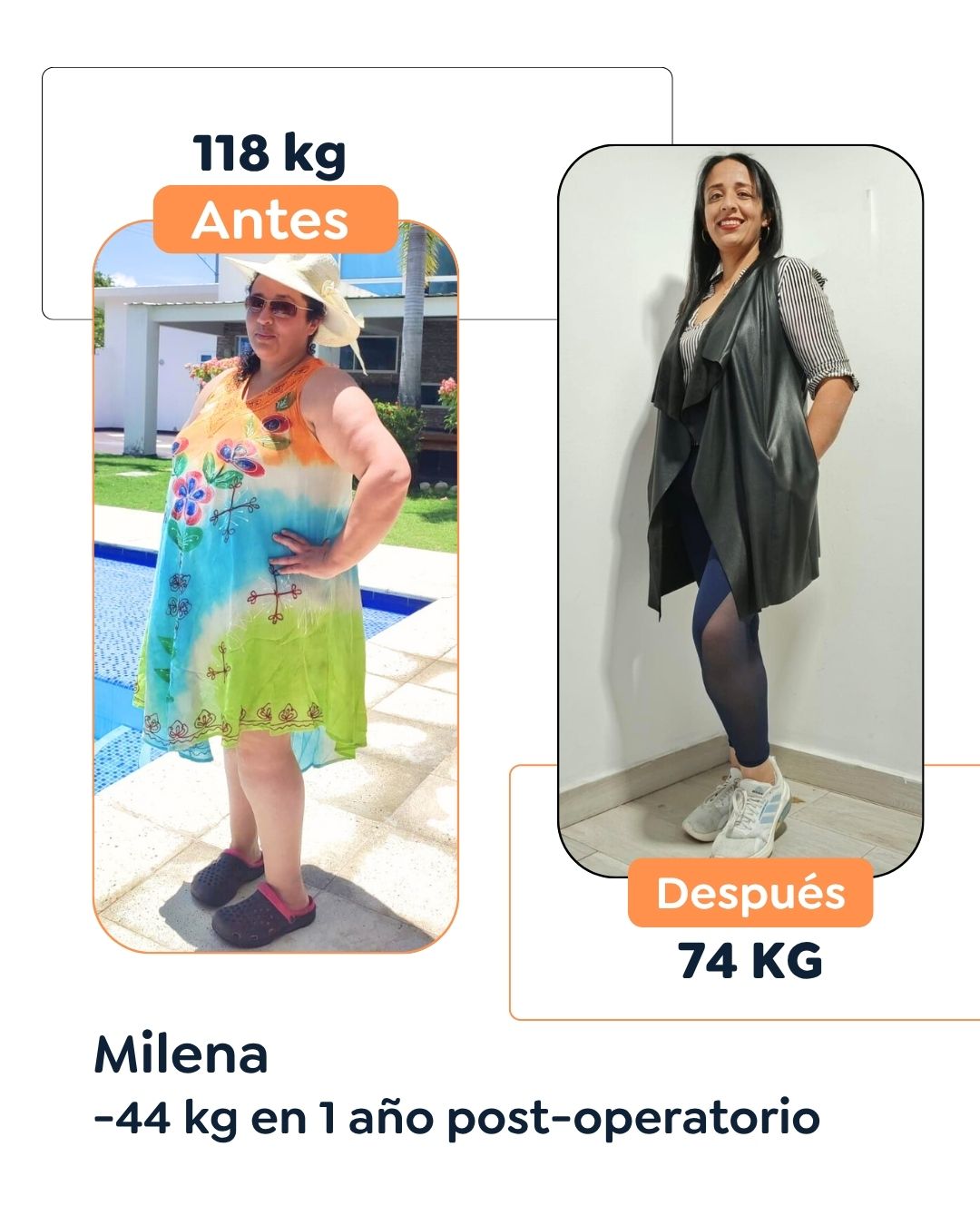 Antes y después de cirugía bariátrica en Bogotá con el Dr. Felipe Bernal - 011125