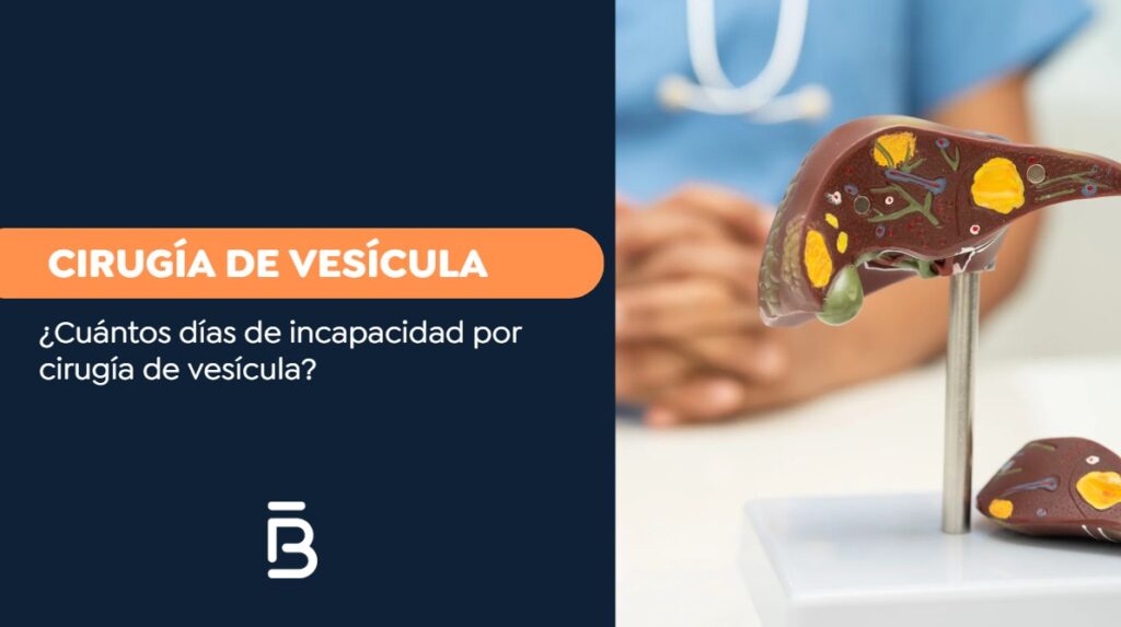 Cirugía de vesicula-Dr. Felipe Bernal
