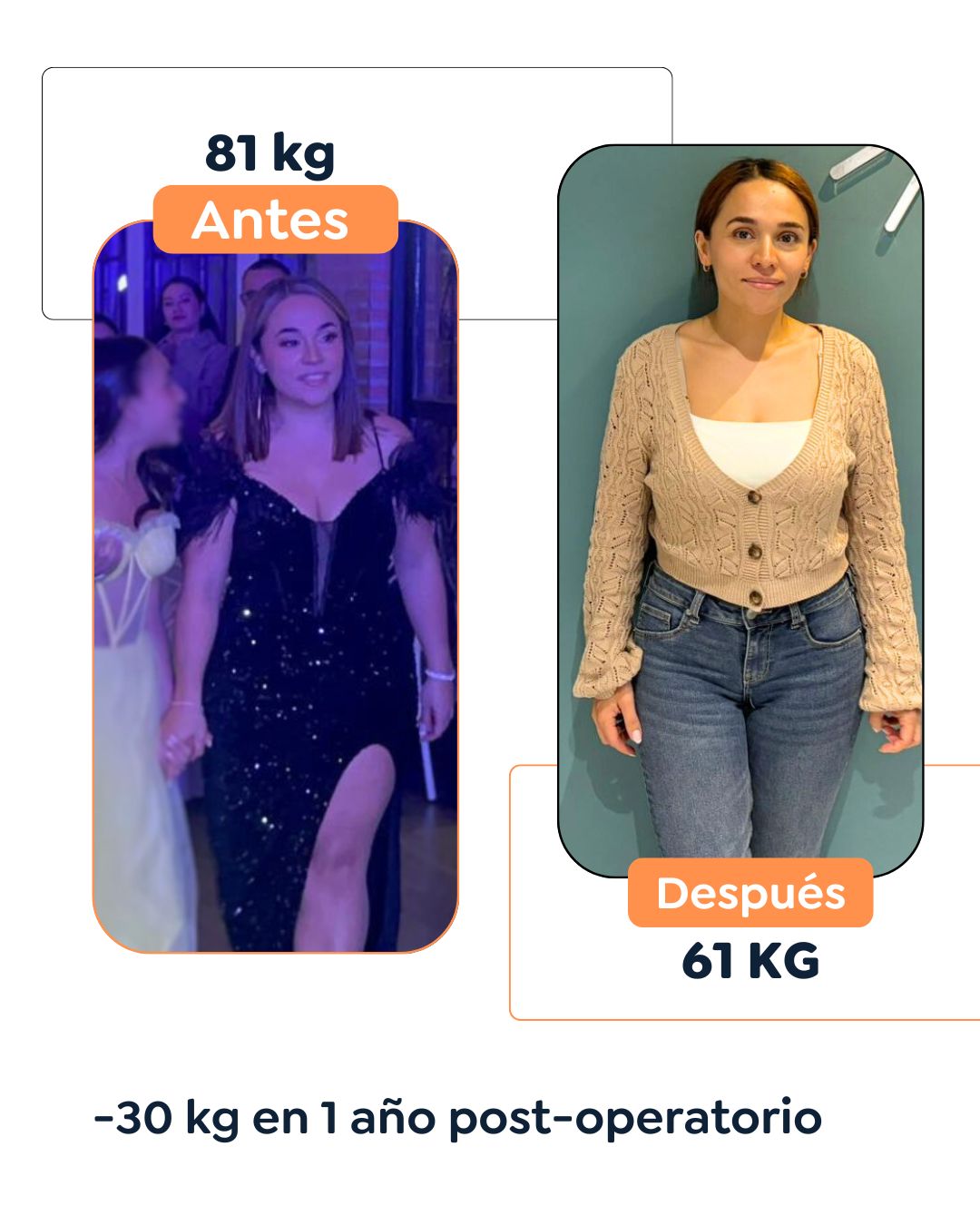 Antes y después de cirugía bariátrica en Bogotá con el Dr. Felipe Bernal - 011225 2