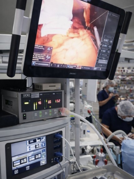 Cirugía robótica bariátrica en Bogotá - Robot Da vinci - carro de visión - Dr. Felipe Bernal