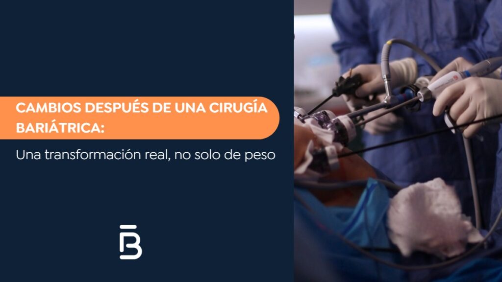 Cambios después de una cirugía bariátrica-Dr. Felipe Bernal