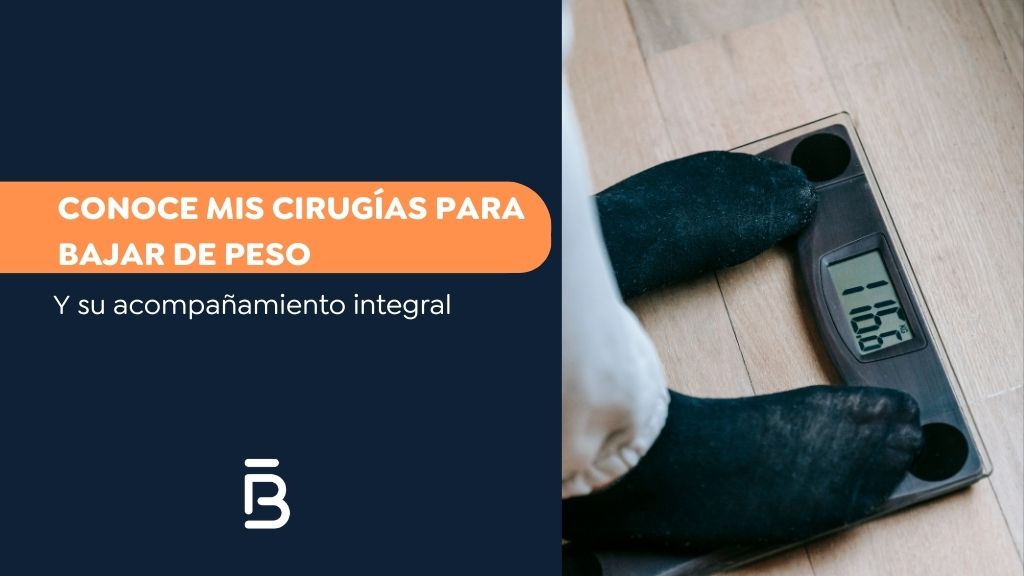 Conoce mis cirugías para bajar de peso - Dr Felipe Bernal 2