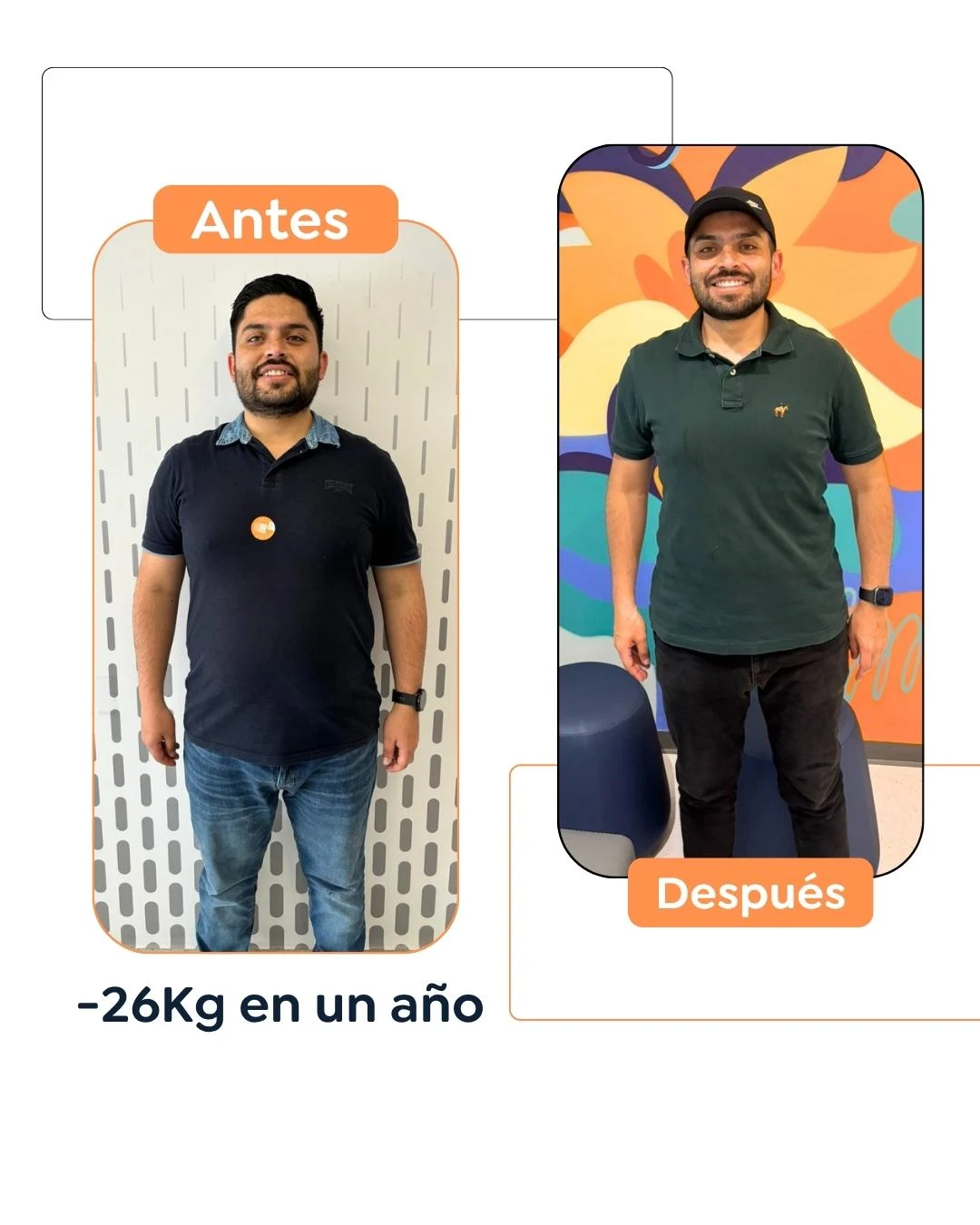 Antes y después de una cirugía bariátrica en Bogotá - Dr. Felipe Bernal - Dr Felipe Bernal