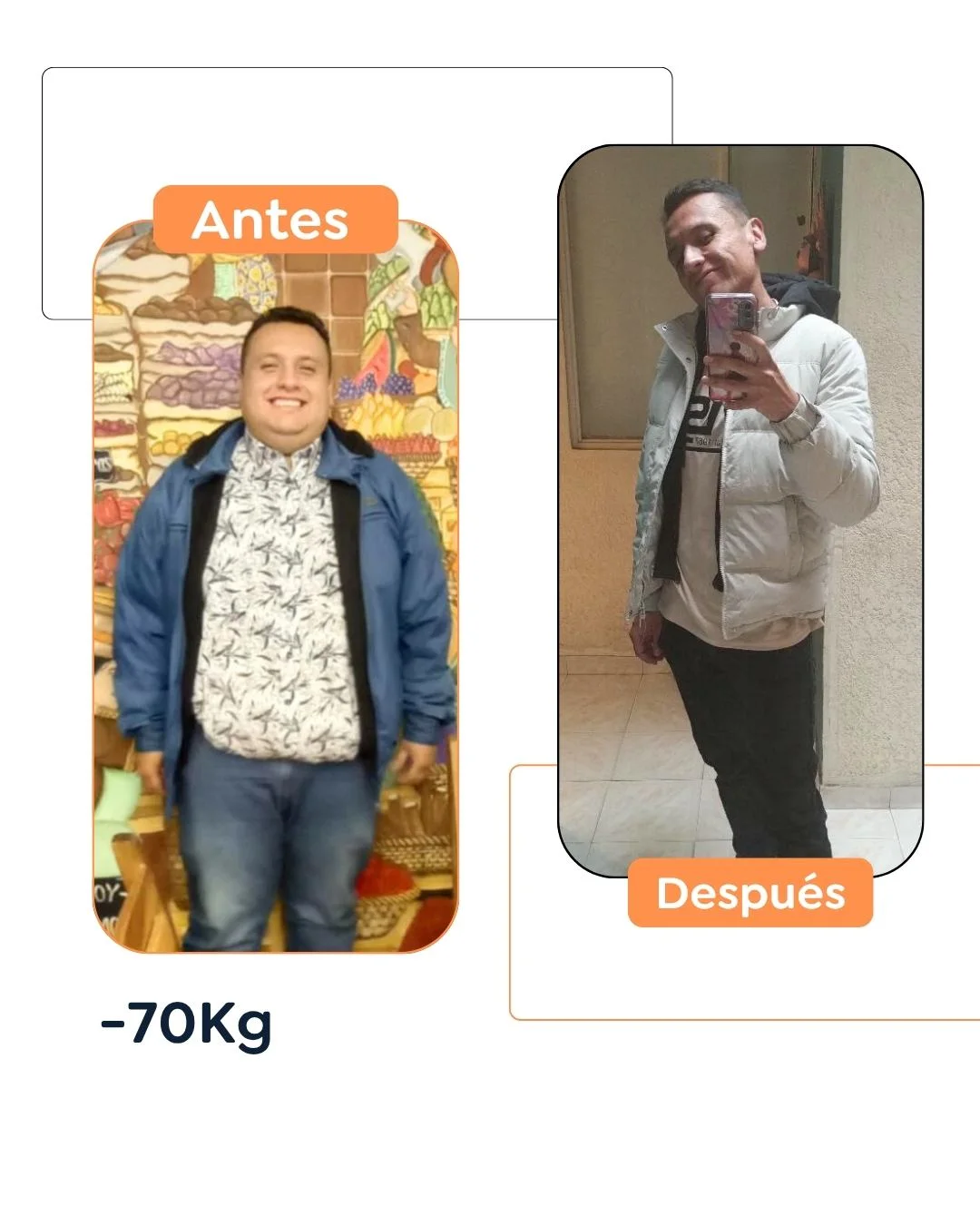 Antes y después de una cirugía bariátrica en Bogotá - Dr. Felipe Bernal - Dr Felipe Bernal